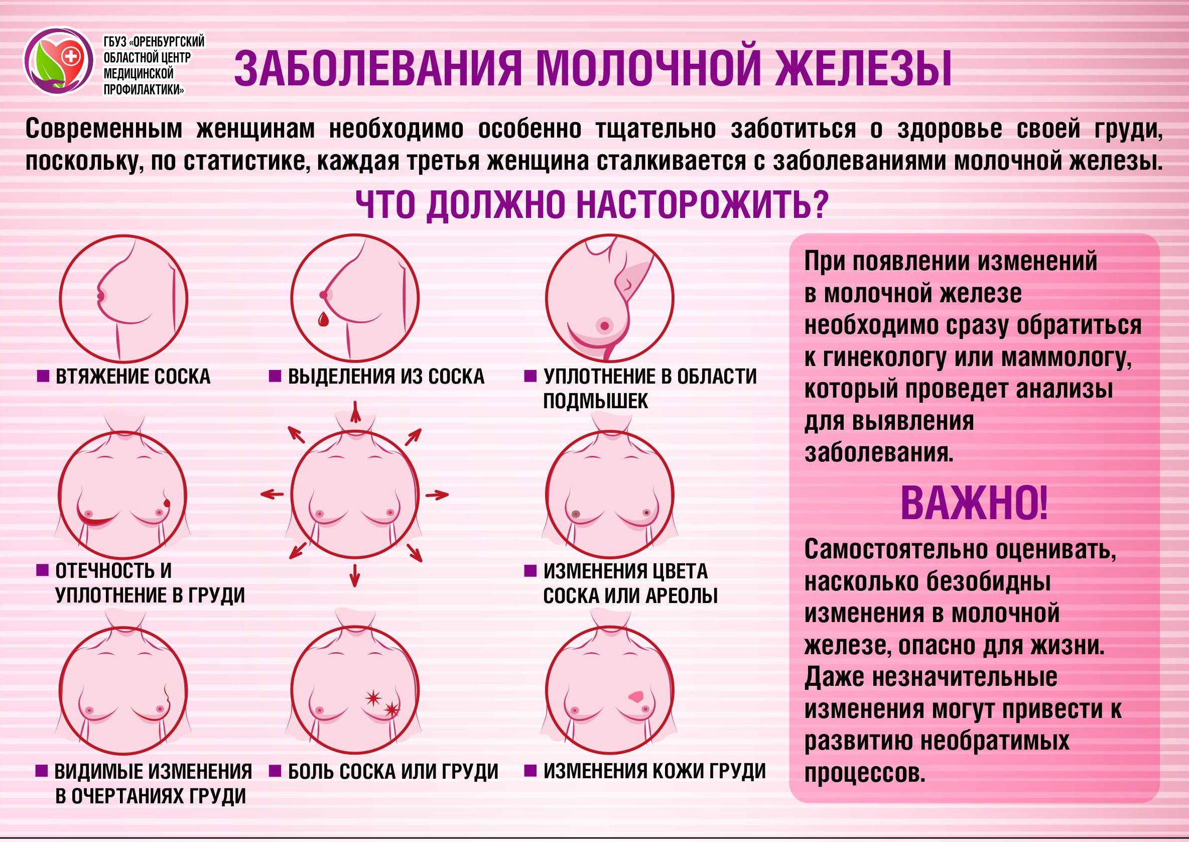 грудь у беременных на ранних сроках фото 110